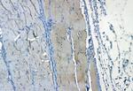 PDLIM3 Antibody in Immunohistochemistry (Paraffin) (IHC (P))