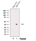 PDLIM3 Antibody in Western Blot (WB)