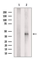 PDLIM3 Antibody in Western Blot (WB)