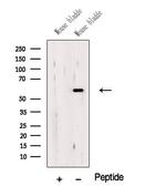OSGIN1 Polyclonal Antibody