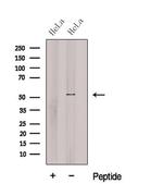 cGAS Polyclonal Antibody