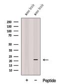 CPLX3 Polyclonal Antibody