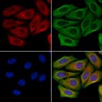 FUT6 Polyclonal Antibody