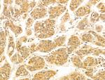 FUT6 Antibody in Immunohistochemistry (Paraffin) (IHC (P))