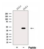 FUT6 Antibody in Western Blot (WB)