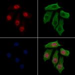 HTATSF1 Polyclonal Antibody