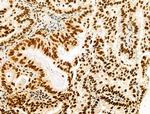 HTATSF1 Antibody in Immunohistochemistry (Paraffin) (IHC (P))