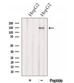 HTATSF1 Antibody in Western Blot (WB)