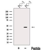 KLF6 Polyclonal Antibody