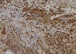 SLC5A5 Polyclonal Antibody