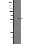 Phospho-p57 Kip2 (Thr310) Polyclonal Antibody