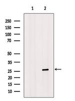 HOXC6 Antibody in Western Blot (WB)