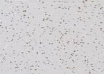 ETK Polyclonal Antibody