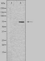 ETK Antibody in Western Blot (WB)