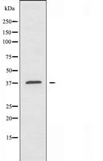 TUSC3 Polyclonal Antibody