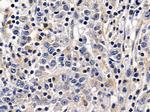 ADH7 Polyclonal Antibody