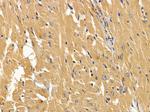 ABCD1 Polyclonal Antibody