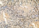 CA13 Antibody in Immunohistochemistry (Paraffin) (IHC (P))