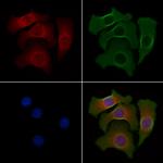 MICS1 Polyclonal Antibody