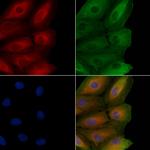 NKp30 Polyclonal Antibody