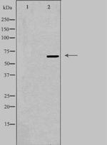 TOR1AIP1 Polyclonal Antibody