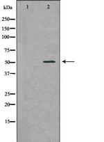 Bcl-rambo Polyclonal Antibody