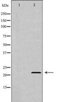 Adenylate Kinase 1 Polyclonal Antibody