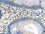 HLA-DRA Antibody in Immunohistochemistry (Paraffin) (IHC (P))