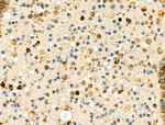 HLA-DRA Antibody in Immunohistochemistry (Paraffin) (IHC (P))
