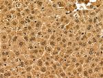 ABCG8 Polyclonal Antibody