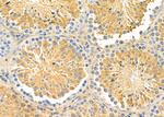 ABCA6 Polyclonal Antibody