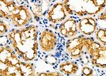UROD Polyclonal Antibody