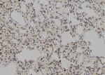 MSH3 Polyclonal Antibody
