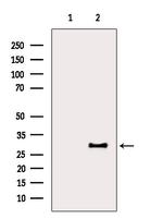 LAT Polyclonal Antibody