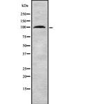 TNPO3 Polyclonal Antibody