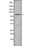MSP Antibody in Western Blot (WB)