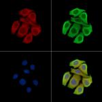 TRBC1 Antibody in Immunocytochemistry (ICC/IF)