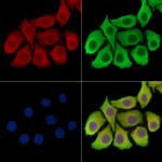 TRBC1 Polyclonal Antibody
