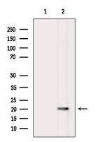 TRBC1 Antibody in Western Blot (WB)