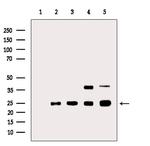 Galectin 4 Antibody in Western Blot (WB)