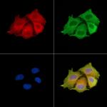 KRT81 Polyclonal Antibody