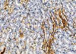 KRT81 Antibody in Immunohistochemistry (Paraffin) (IHC (P))