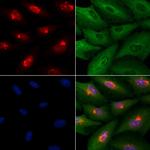 BAF53B Polyclonal Antibody