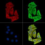 ETNPPL Isoform 1 Polyclonal Antibody