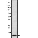 ATP5E Polyclonal Antibody