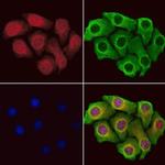 BCCIP Polyclonal Antibody