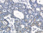 Claudin 9 Antibody in Immunohistochemistry (Paraffin) (IHC (P))