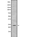 Claudin 9 Antibody in Western Blot (WB)