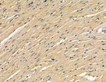 TOP1MT Polyclonal Antibody