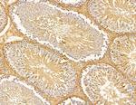 LRP12 Isoform A Precursor Antibody in Immunohistochemistry (Paraffin) (IHC (P))